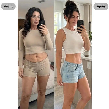 Appareil anti-cellulite