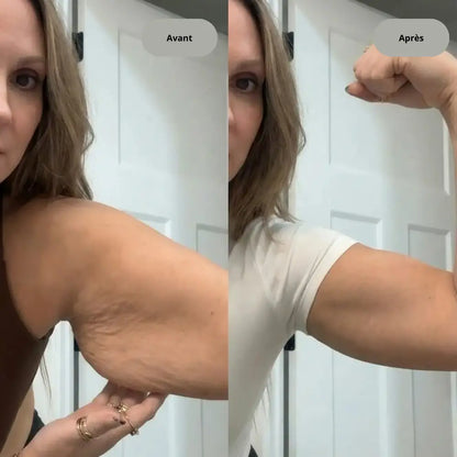 Appareil anti-cellulite