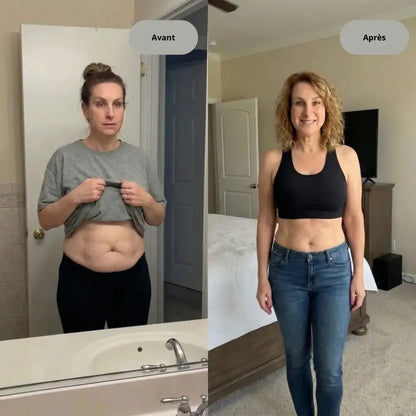 Appareil anti-cellulite